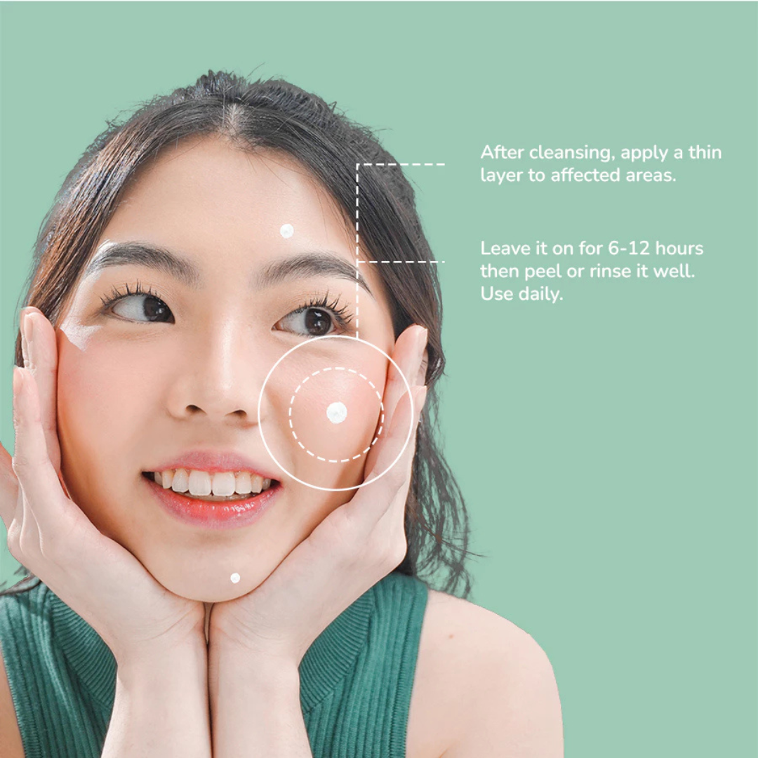 IWHITE KOREA Acne+ Pimple Clay Patch 15ml