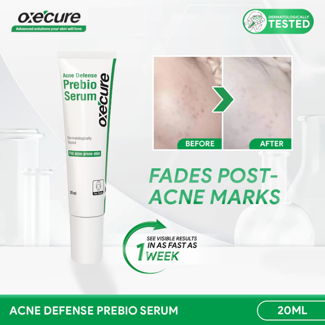 Oxecure Acne Defense Prebio Serum 20ml