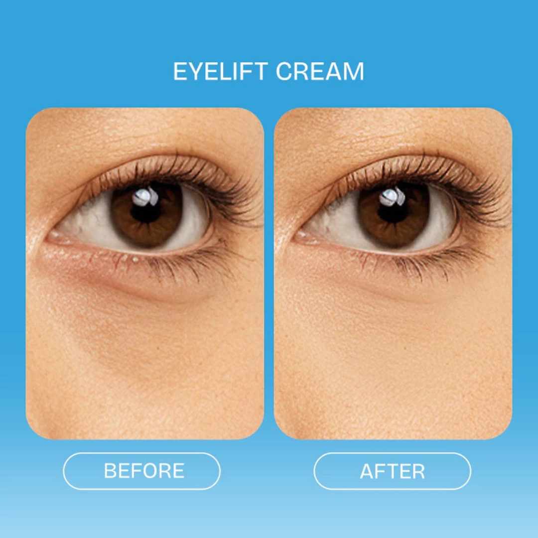 QUICKFX Eye Lift Cream (Ellagic Acid, Niacinamide + Bakuchiol)