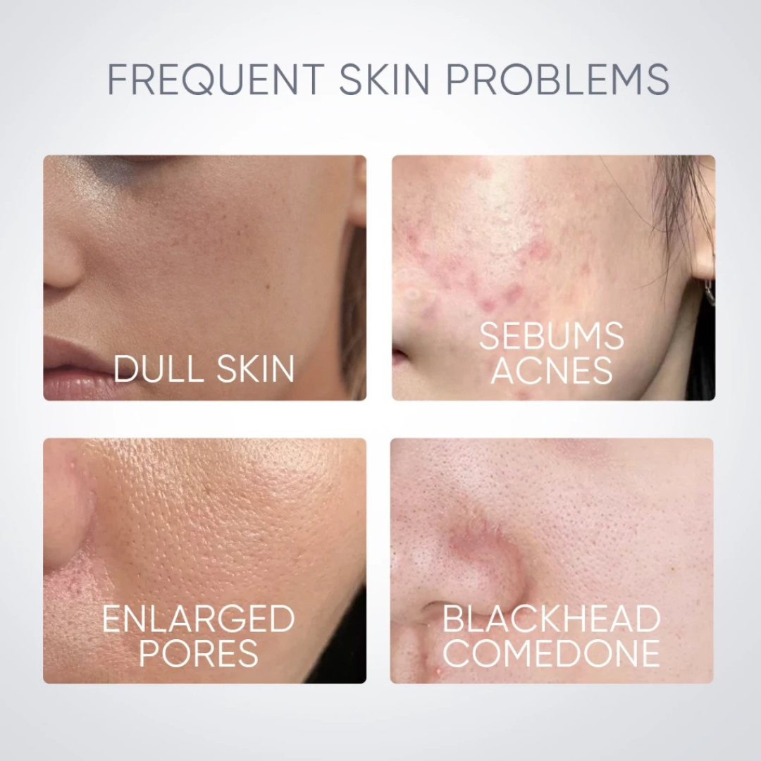 Skintific Alaska Volcano Pore Clay Stick 40g