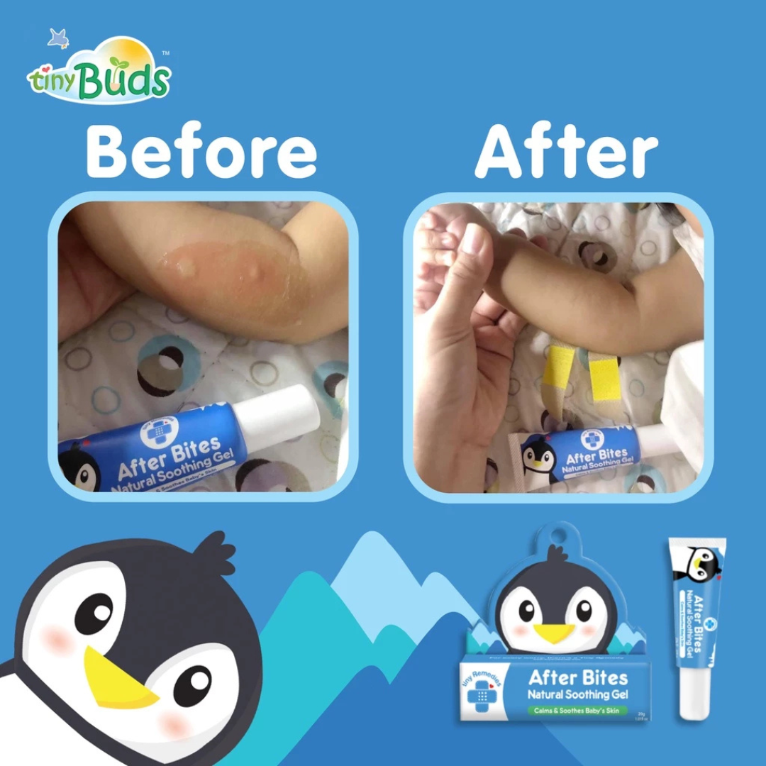 TINY BUDS Natural Soothing Gel (After Bites) 20g