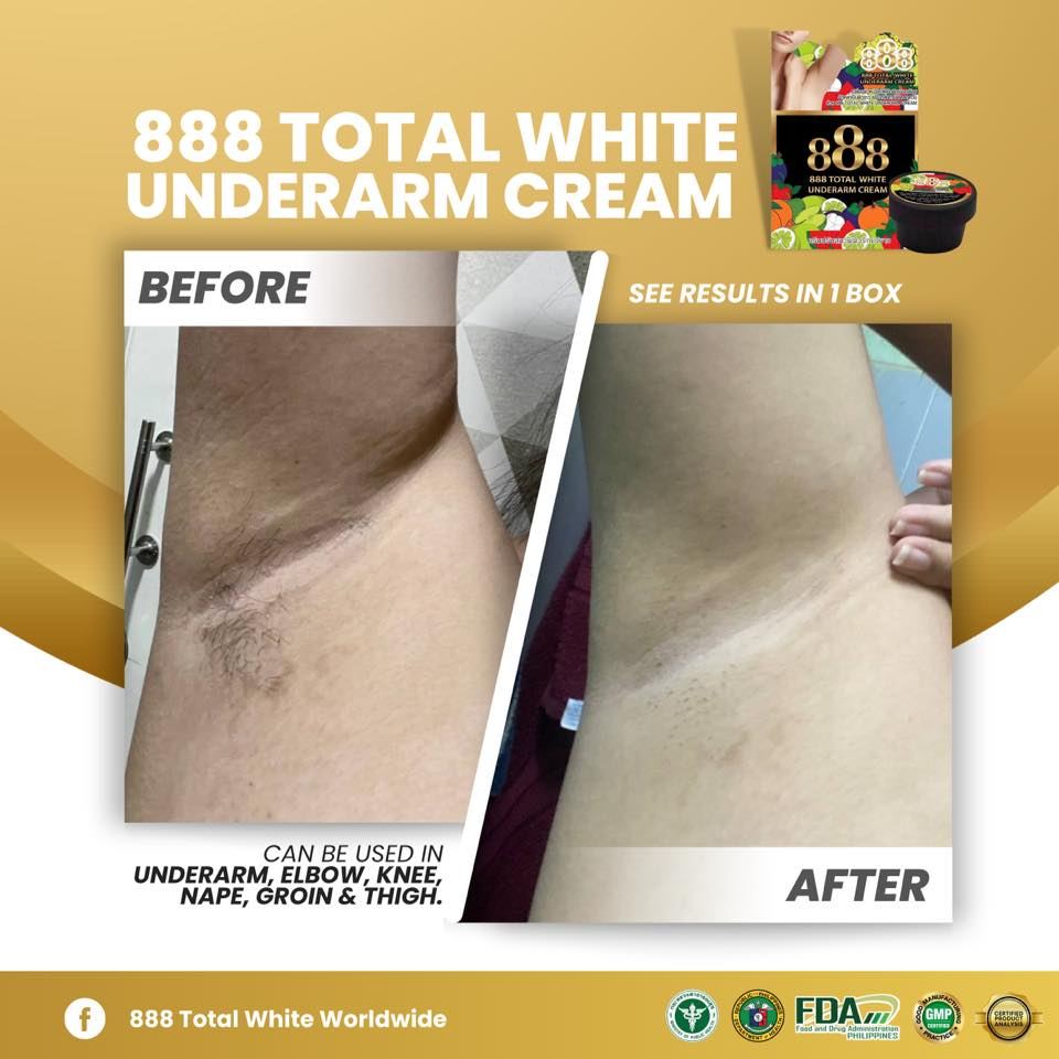 888 Total White Underarm Cream (Net Weight 35g)