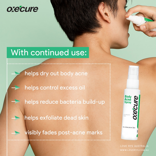 Oxecure Body Acne Spray 