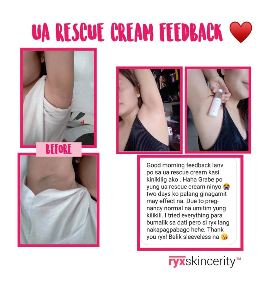 RyxSkin Underarm Rescue Whitening Cream 30mL