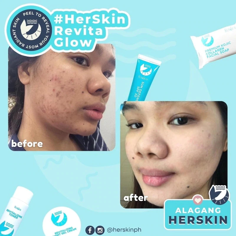 HerSkin Revita-Glow Skin Rescue Set